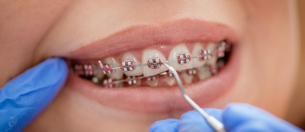wizyta kontrolna u ortodonty